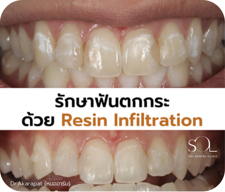 ทำฟัน ผ่อนคลาย